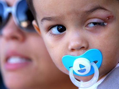 Menino de 1 ano e 7 meses é vitima de erro médico em Jacarepaguá