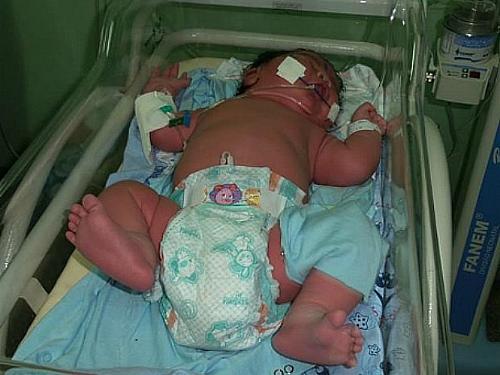 Bebe Nasce Com Quase 7 Kg Em Maternidade De Parintins Alagoas 24 Horas Lider Em Noticias On Line De Alagoas