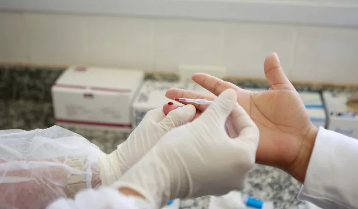 Alagoas registra aumento de casos confirmados de HIV